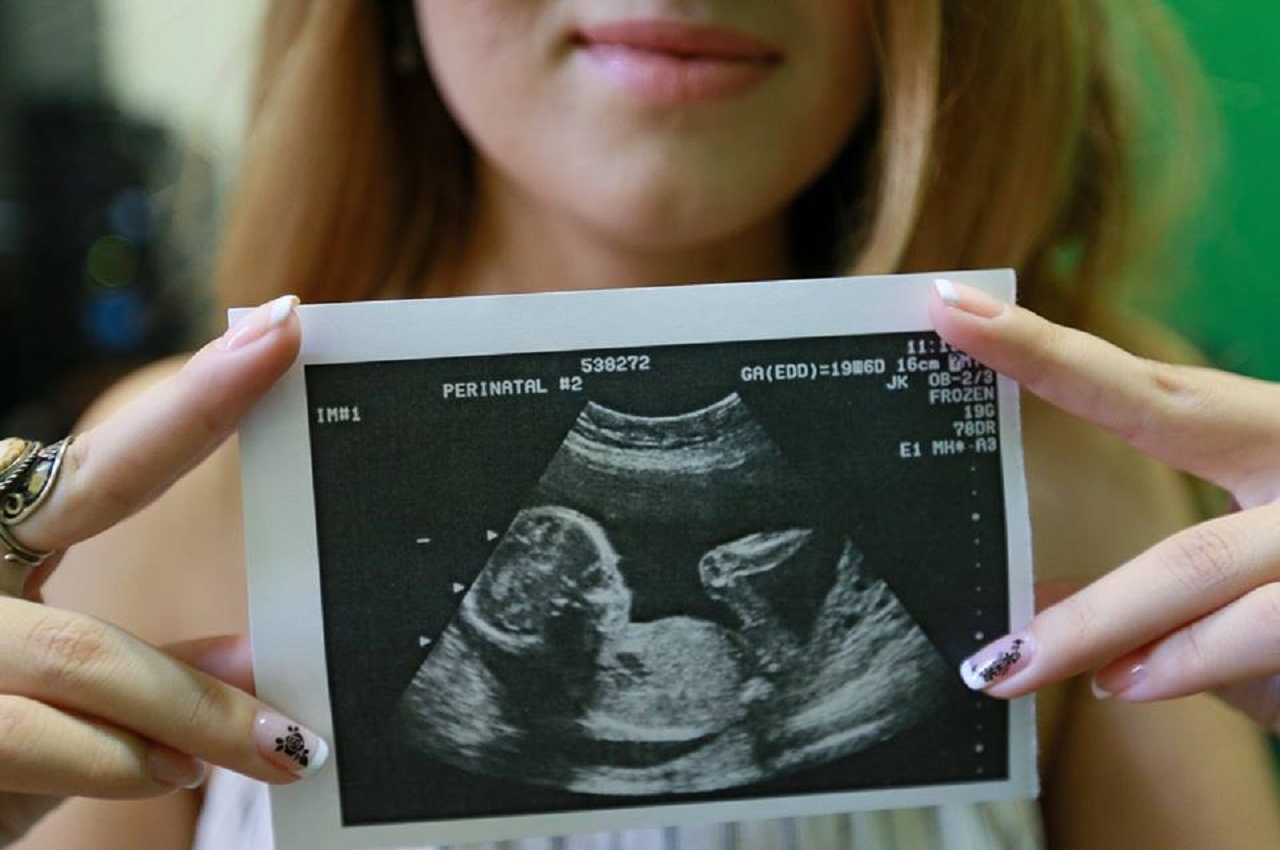 Будет в 44 неделе. УЗИ 12 недель беременности девочка. Мальчик на УЗИ. УЗИ мальчик или девочки.